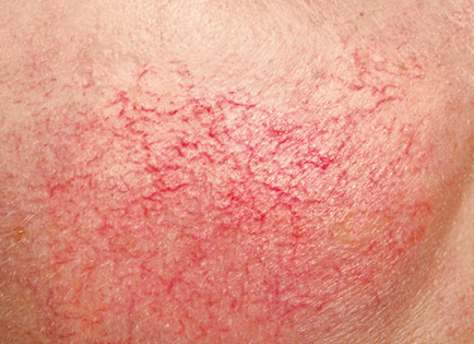 corso di make up dermatologia cosmetologia pelli problematiche corso trucco make up preparazione pelle skincare acne vitiligine dermatite cosmetologia