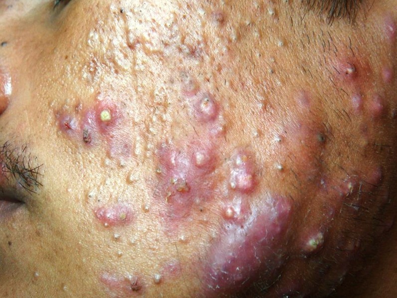 corso di make up dermatologia cosmetologia pelli problematiche corso di make up dermatologia cosmetologia pelli problematiche